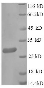 Recombinant Human IgG receptor FcRn large subunit p51 (FCGRT), partial – Figure 1 of 1