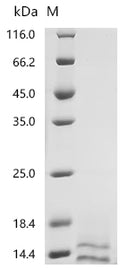 (Tris-Glycine gel) Discontinuous SDS-PAGE (reduced) with 5% enrichment gel and 15% separation gel.