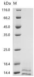 (Tris-Glycine gel) Discontinuous SDS-PAGE (reduced) with 5% enrichment gel and 15% separation gel.