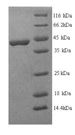 Recombinant Human Fibroblast growth factor receptor 3 (FGFR3), partial – Figure 1 of 1