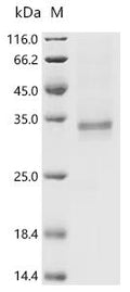 (Tris-Glycine gel) Discontinuous SDS-PAGE (reduced) with 5% enrichment gel and 15% separation gel.