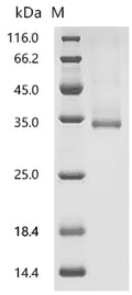 (Tris-Glycine gel) Discontinuous SDS-PAGE (reduced) with 5% enrichment gel and 15% separation gel.
