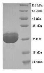 Recombinant Human Filaggrin (FLG), partial – Figure 1 of 1
