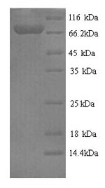 Recombinant Human Fucose-1-phosphate guanylyltransferase (FPGT) – Figure 1 of 1