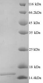 Recombinant Mouse Frataxin,mitochondrial (Fxn), partial – Figure 1 of 1