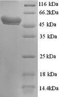 Recombinant Human N-acetylgalactosamine-6-sulfatase (GALNS) – Figure 1 of 1