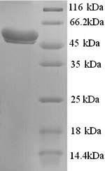 Recombinant Human N-acetylgalactosamine-6-sulfatase (GALNS) – Figure 1 of 1