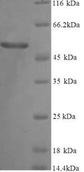 (Tris-Glycine gel) Discontinuous SDS-PAGE (reduced) with 5% enrichment gel and 15% separation gel.