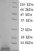 Recombinant Human Pro-glucagon (GCG), partial – Figure 1 of 1