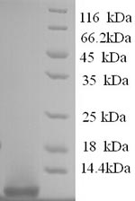 Recombinant Human Pro-glucagon (GCG), partial – Figure 1 of 1