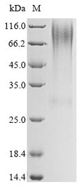 (Tris-Glycine gel) Discontinuous SDS-PAGE (reduced) with 5% enrichment gel and 15% separation gel.