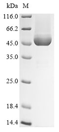 (Tris-Glycine gel) Discontinuous SDS-PAGE (reduced) with 5% enrichment gel and 15% separation gel.