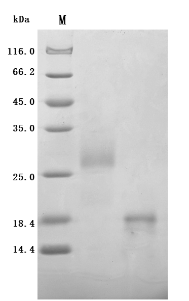 Recombinant Human Glucagon-like peptide 1 receptor (GLP1R), partial – Figure 1 of 1