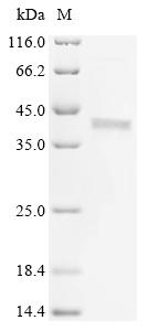 (Tris-Glycine gel) Discontinuous SDS-PAGE (reduced) with 5% enrichment gel and 15% separation gel.