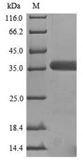 (Tris-Glycine gel) Discontinuous SDS-PAGE (reduced) with 5% enrichment gel and 15% separation gel.
