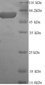 Recombinant Rat Glypican-3 (Gpc3), partial – Figure 1 of 1