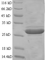 Recombinant Mouse Glypican-4 (Gpc4), partial – Figure 1 of 1