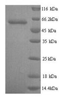 Recombinant Human Glypican-6 (GPC6) – Figure 1 of 1