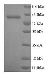 Recombinant Human Glypican-6 (GPC6) – Figure 1 of 1