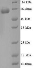 Recombinant Mouse Glucose-6-phosphate isomerase (Gpi) – Figure 1 of 1
