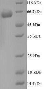 Recombinant Mouse Glucose-6-phosphate isomerase (Gpi) – Figure 1 of 1