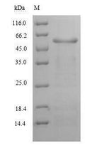 Recombinant Human Alanine aminotransferase 1 (GPT) – Figure 1 of 1