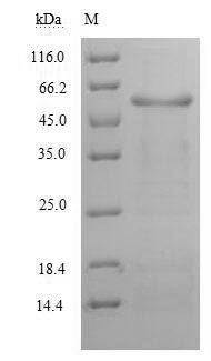 Recombinant Human Alanine aminotransferase 1 (GPT) – Figure 1 of 1