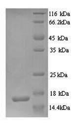 Recombinant Human Glutamate receptor 3 (GRIA3), partial – Figure 1 of 1