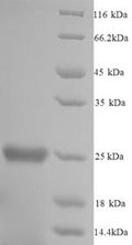 Recombinant Mouse Glutathione S-transferase P 1 (Gstp1) – Figure 1 of 1