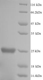 Recombinant Mouse Glutathione S-transferase P 1 (Gstp1) – Figure 1 of 1