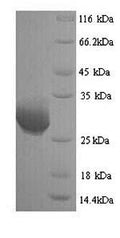 Recombinant Human Granzyme B (GZMB) – Figure 1 of 1
