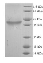 Recombinant Mouse Hyaluronan synthase 2 (Has2), partial – Figure 1 of 1
