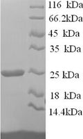 Recombinant Human Hepatitis A virus cellular receptor 2 (HAVCR2), partial – Figure 1 of 1