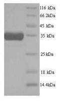 Recombinant Mouse Heme oxygenase 1 (Hmox1) – Figure 1 of 1