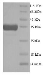 Recombinant Mouse Heme oxygenase 1 (Hmox1) – Figure 1 of 1