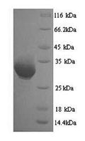 Recombinant Human Heterogeneous nuclear ribonucleoproteins A2/B1 (HNRNPA2B1) – Figure 1 of 1