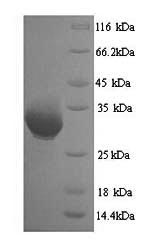 Recombinant Human Heterogeneous nuclear ribonucleoproteins A2/B1 (HNRNPA2B1) – Figure 1 of 1