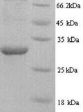 Recombinant Human HNRNPL protein (HNRNPL), partial – Figure 1 of 1