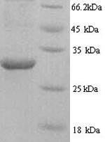 Recombinant Human HNRNPL protein (HNRNPL), partial – Figure 1 of 1