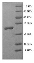 Recombinant Human Homeobox protein Hox-B4 (HOXB4) – Figure 1 of 1