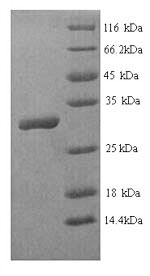 Recombinant Human Homeobox protein Hox-B4 (HOXB4) – Figure 1 of 1