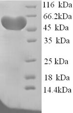 Recombinant Rat Hemopexin (Hpx) – Figure 1 of 1
