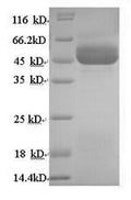 Recombinant Human 11-beta-hydroxysteroid dehydrogenase type 2 (HSD11B2) – Figure 1 of 1