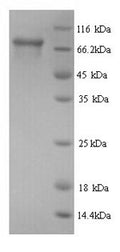 Recombinant Human Peroxisomal multifunctional enzyme type 2 (HSD17B4) – Figure 1 of 1