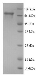 Recombinant Human Peroxisomal multifunctional enzyme type 2 (HSD17B4) – Figure 1 of 1