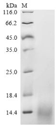 (Tris-Glycine gel) Discontinuous SDS-PAGE (reduced) with 5% enrichment gel and 15% separation gel.