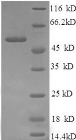 Recombinant Human Islet cell autoantigen 1 (ICA1), partial – Figure 1 of 1