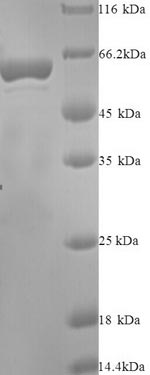 Recombinant Human Indoleamine 2,3-dioxygenase 2 (IDO2) – Figure 1 of 1