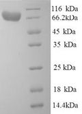 Recombinant Human Alpha-L-iduronidase (IDUA) – Figure 1 of 1