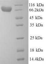 Recombinant Human Alpha-L-iduronidase (IDUA) – Figure 1 of 1